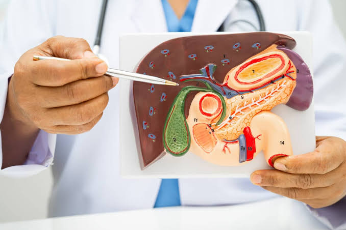 Gallstone Disease Management